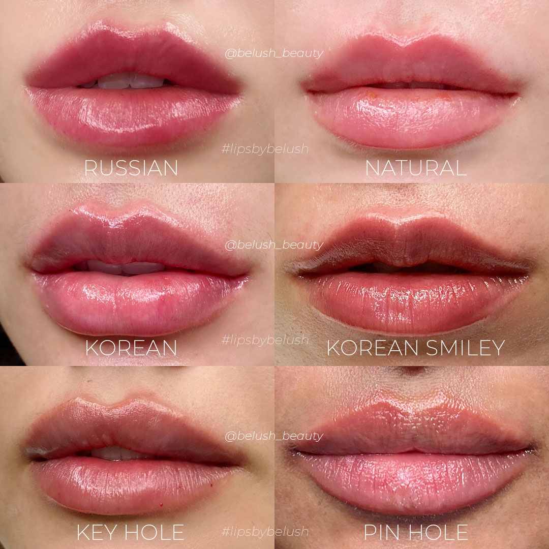 lip filler type and styles