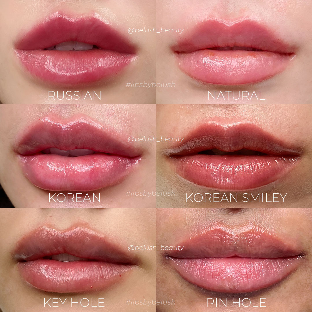 Lip Filler  Belush Beauty - The Lip Experts in Malaysia